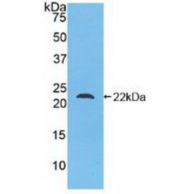 Glucagon (GCG) Human Polyclonal Antibody