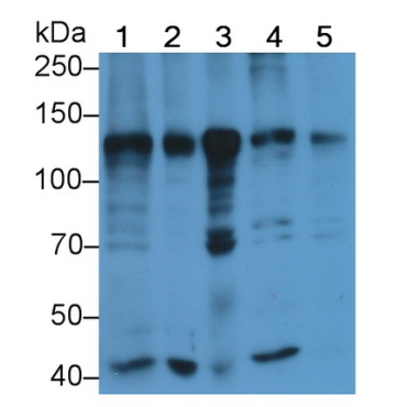 ATP Dependent DNA ligase I (LIG1) Human Polyclonal Antibody