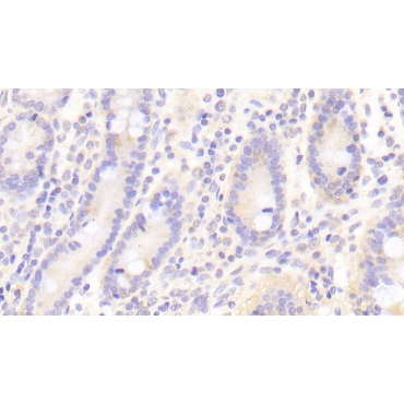 Fc Fragment Of IgG Low Affinity IIIb Receptor (FcgR3B) Human Polyclonal Antibody
