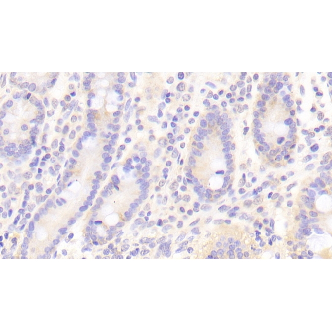 Fc Fragment Of IgG Low Affinity IIIb Receptor (FcgR3B) Human Polyclonal Antibody