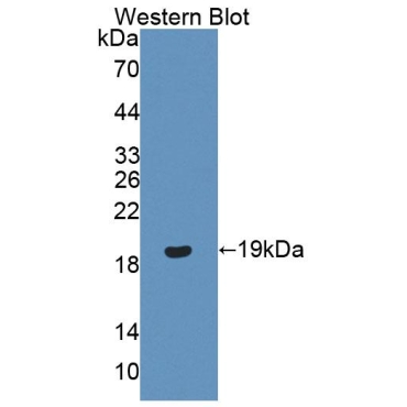 Progesterone Receptor (PGR) Human Polyclonal Antibody