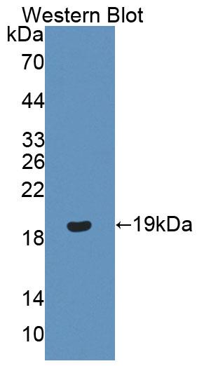 Progesterone Receptor (PGR) Human Polyclonal Antibody