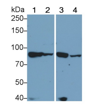 Lipase, Hormone Sensitive (LIPE) Mouse Polyclonal Antibody