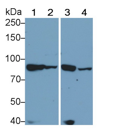 Lipase, Hormone Sensitive (LIPE) Mouse Polyclonal Antibody