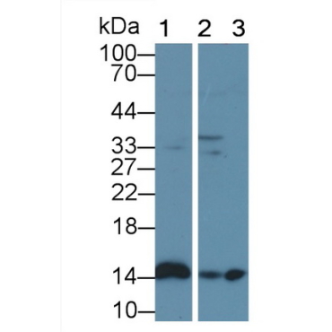 Fatty Acid Binding Protein 7, Brain (FABP7) Human Polyclonal Antibody