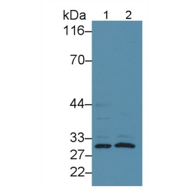 Fc Fragment Of IgG Low Affinity IIIa Receptor (FcgR3A) Human Polyclonal Antibody
