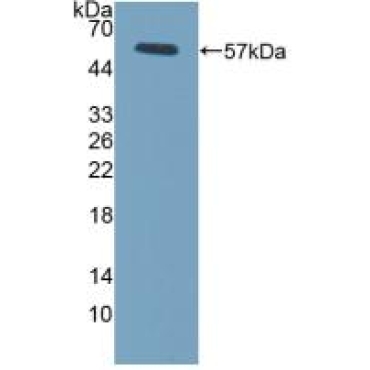 Fc Fragment Of IgG Low Affinity IIIa Receptor (FcgR3A) Mouse Polyclonal Antibody
