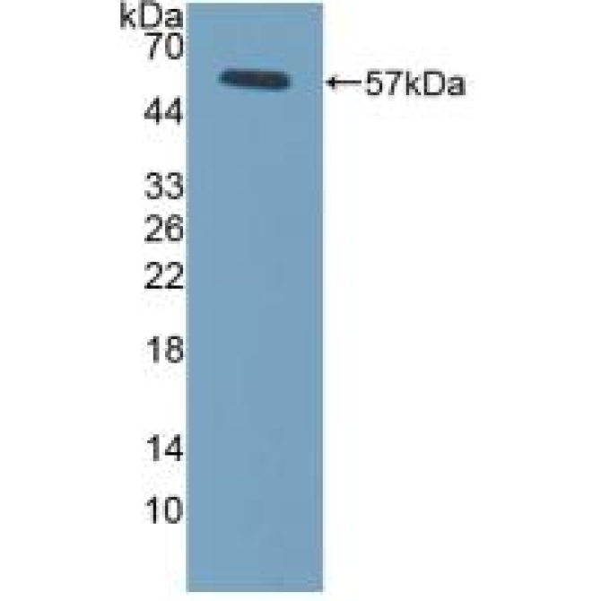Fc Fragment Of IgG Low Affinity IIIa Receptor (FcgR3A) Mouse Polyclonal Antibody