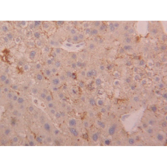 Cathepsin D (CTSD) Human Polyclonal Antibody