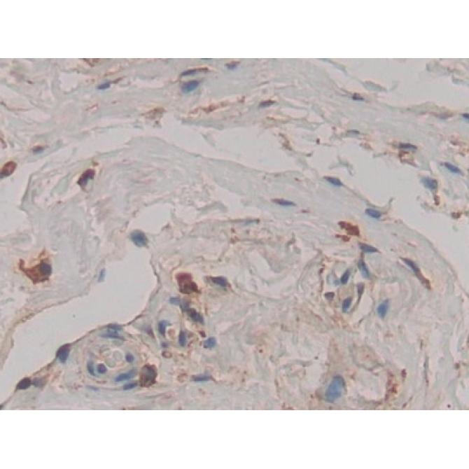 Cathepsin D (CTSD) Human Polyclonal Antibody