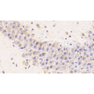 Cathepsin D (CTSD) Mouse Polyclonal Antibody