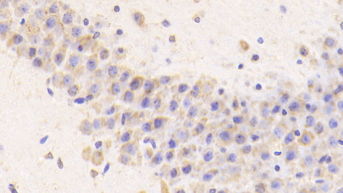 Cathepsin D (CTSD) Mouse Polyclonal Antibody