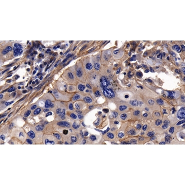 Integrin Alpha V (ITGaV) Human Polyclonal Antibody
