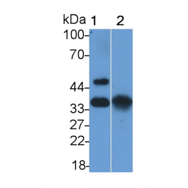 Epithelial Cell Adhesion Molecule (EPCAM) Human Polyclonal Antibody