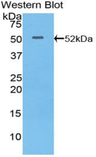 Integrin Alpha 6 (ITGa6) Mouse Polyclonal Antibody