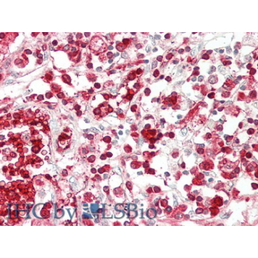 ATP Binding Cassette Transporter G1 (ABCG1) Human Polyclonal Antibody