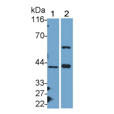 V-Jun Sarcoma Virus 17 Oncogene Homolog (JUN) Human Polyclonal Antibody