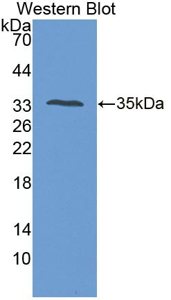 Protein Tyrosine Phosphatase Receptor Type S (PTPRS) Human Polyclonal Antibody