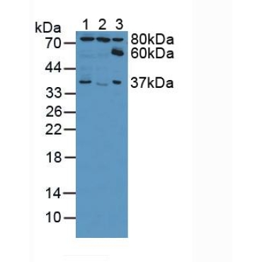 Ezrin (EZR) Human Polyclonal Antibody