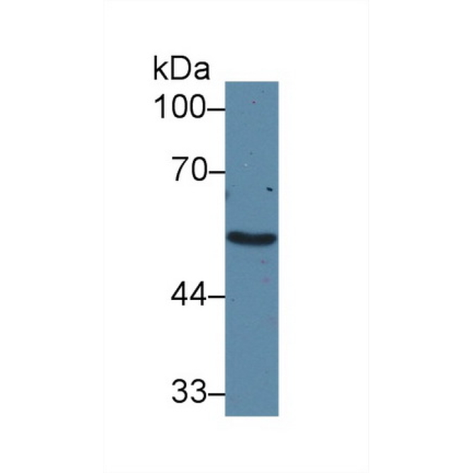Adrenergic Receptor Alpha 1A (ADRa1A) Human Polyclonal Antibody