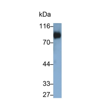 Cluster of Differentiation 42d (CD42d) Human Polyclonal Antibody