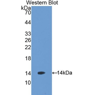 Agouti Related Protein (AGRP) Mouse Polyclonal Antibody