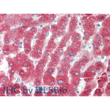 Complement C4-B (C4B) Human Polyclonal Antibody