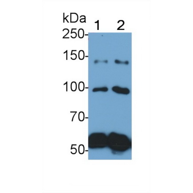 Complement C4-B (C4B) Human Polyclonal Antibody