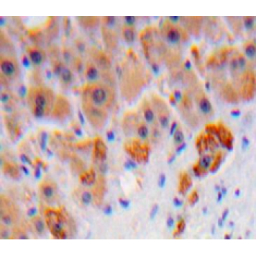 Complement Component 8b (C8b) Human Polyclonal Antibody