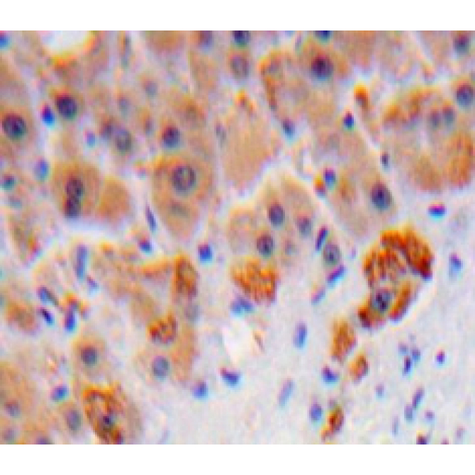 Complement Component 8b (C8b) Human Polyclonal Antibody