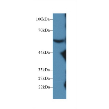 Complement Component 8b (C8b) Mouse Polyclonal Antibody