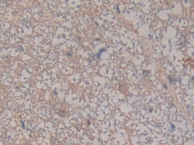 Complement Component 8b (C8b) Rat Polyclonal Antibody