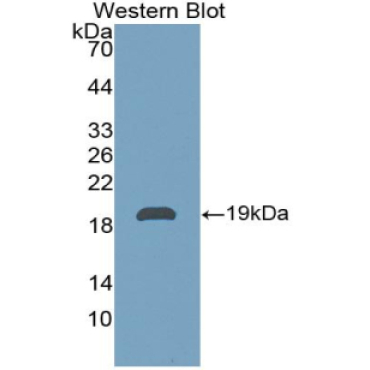 Pleiotrophin (PTN) Human Polyclonal Antibody