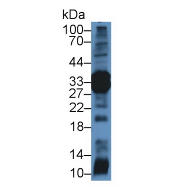 Chymotrypsin C (CTRC) Mouse Polyclonal Antibody