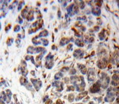Proopiomelanocortin (POMC) Human Polyclonal Antibody