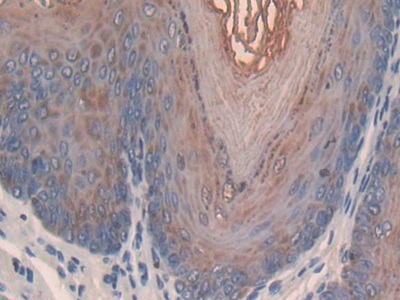 Secretory Leukocyte Peptidase Inhibitor (SLPI) Mouse Polyclonal Antibody