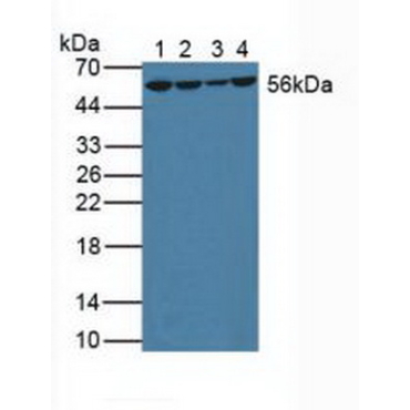 Glutathione Reductase (GR) Human Polyclonal Antibody