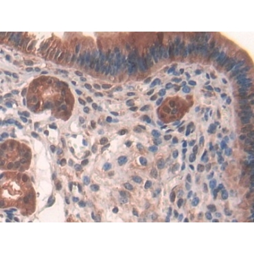 Glutathione Reductase (GR) Mouse Polyclonal Antibody