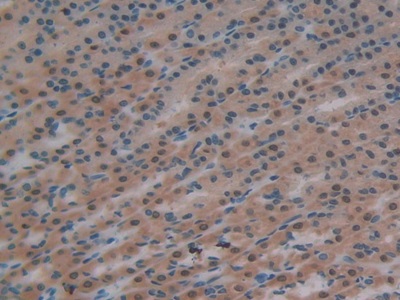 Glutathione Reductase (GR) Rat Polyclonal Antibody