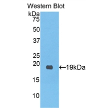 Procollagen C-Endopeptidase Enhancer (PCOLCE) Human Polyclonal Antibody