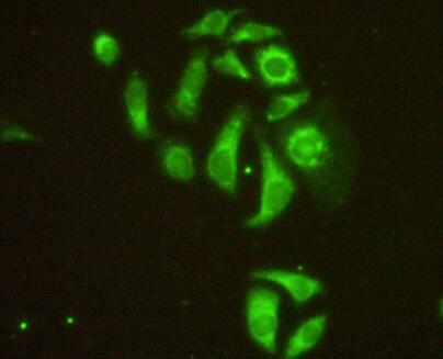 Microtubule Associated Protein 4 (MAP4) Rat Polyclonal Antibody