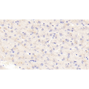 Thymic Stromal Lymphopoietin (TSLP) Human Polyclonal Antibody