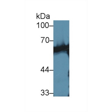 Calcineurin (CaN) Human Polyclonal Antibody