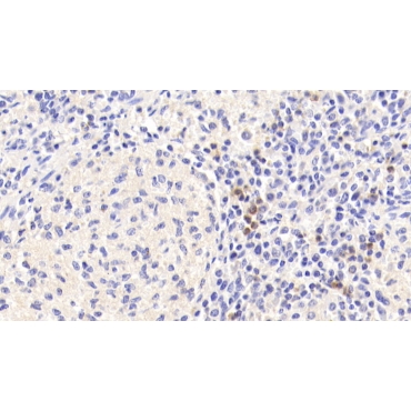 Tetraspanin 25 (TSPAN25) Human Polyclonal Antibody