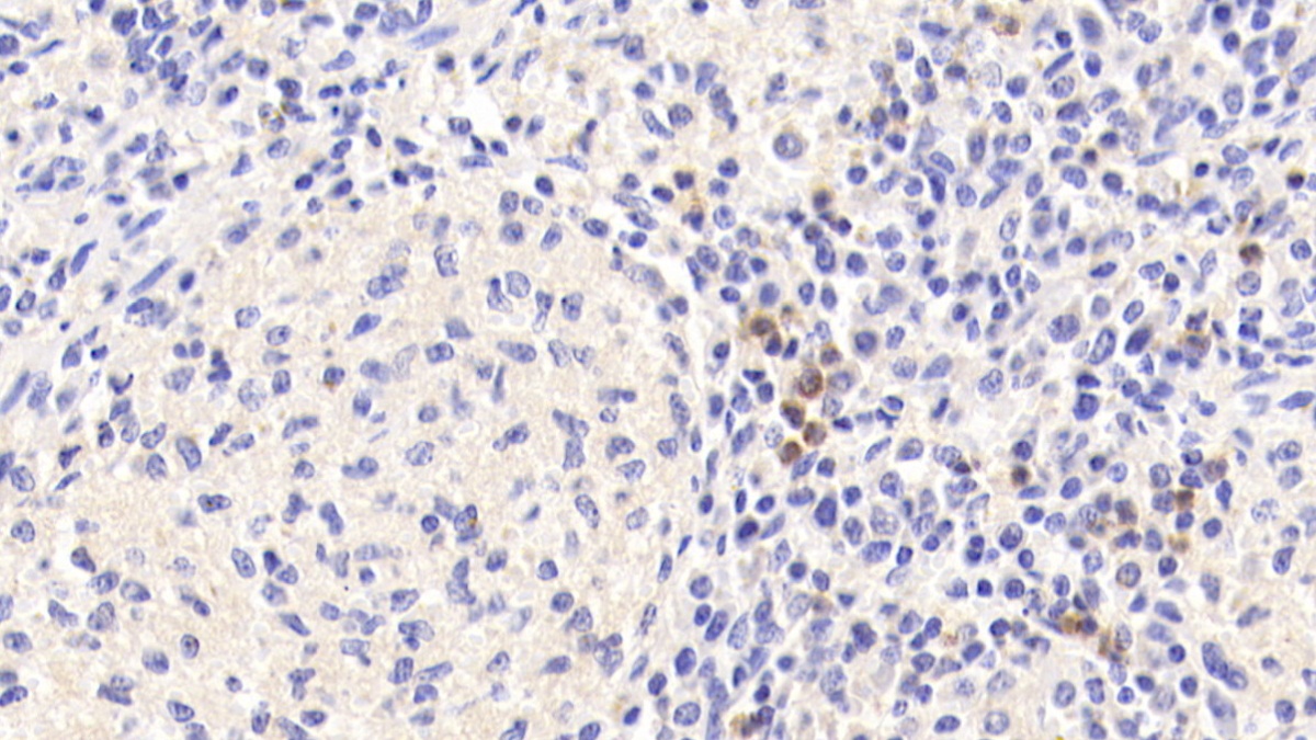 Tetraspanin 25 (TSPAN25) Human Polyclonal Antibody