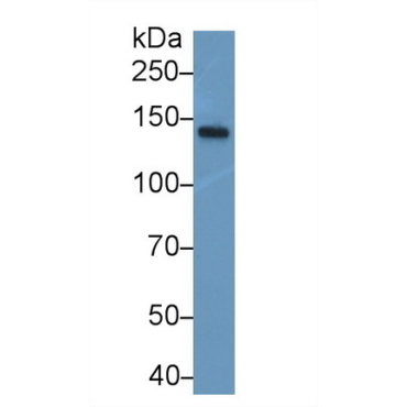 Neurofilament 3 (NEF3) Human Polyclonal Antibody