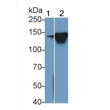 Neurofilament 3 (NEF3) Human Polyclonal Antibody