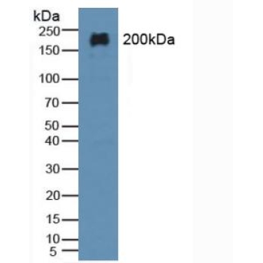 Microtubule Associated Protein 2 (MAP2) Human Polyclonal Antibody