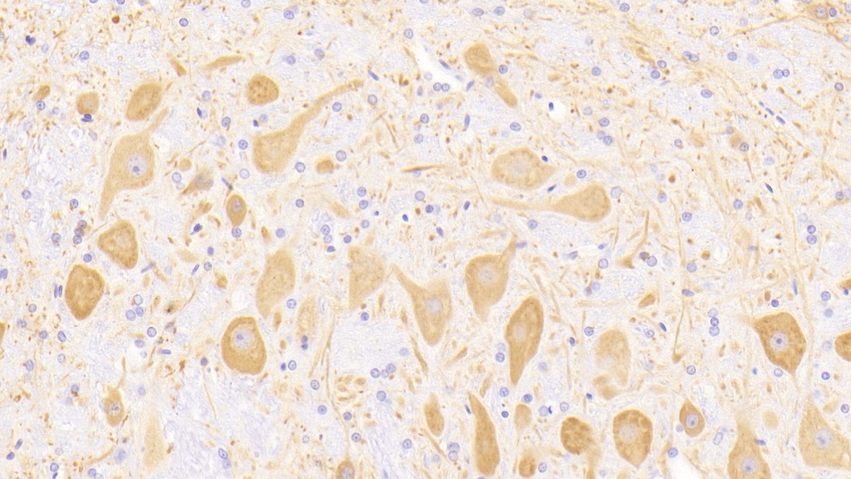 Microtubule Associated Protein 2 (MAP2) Rat Polyclonal Antibody