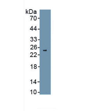 Melanoma Associated ME20 (ME20M) Human Polyclonal Antibody